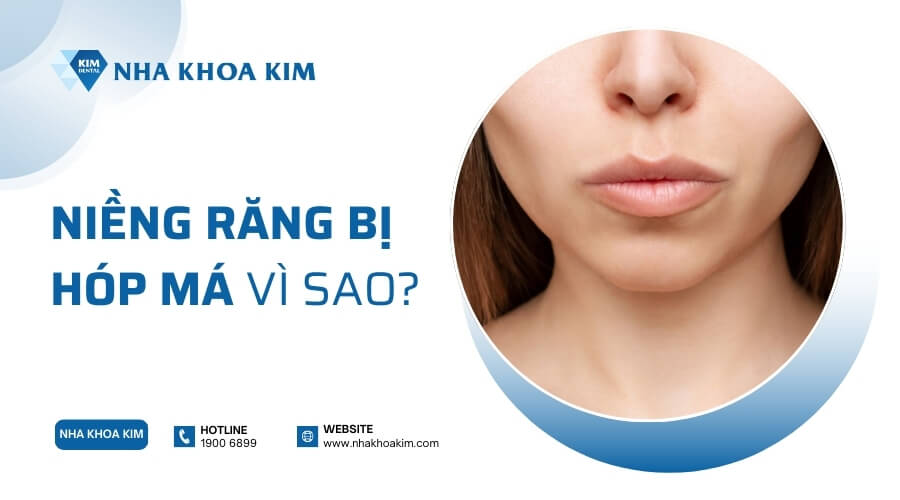Tại sao niềng răng bị hóp má?