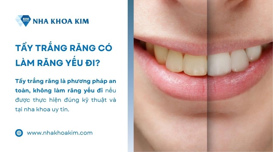 tẩy trắng răng có làm răng yếu đi không