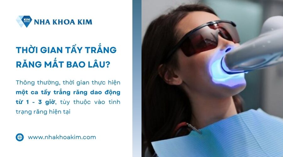 tẩy trắng răng mất bao lâu