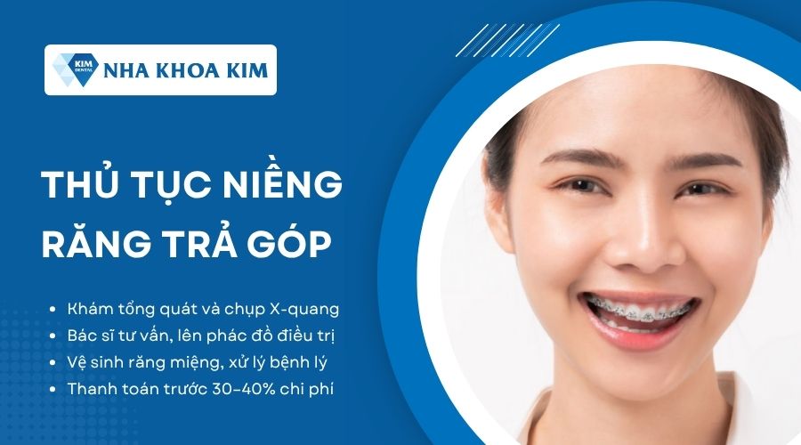 Thủ tục niềng răng trả góp tại Nha Khoa Kim