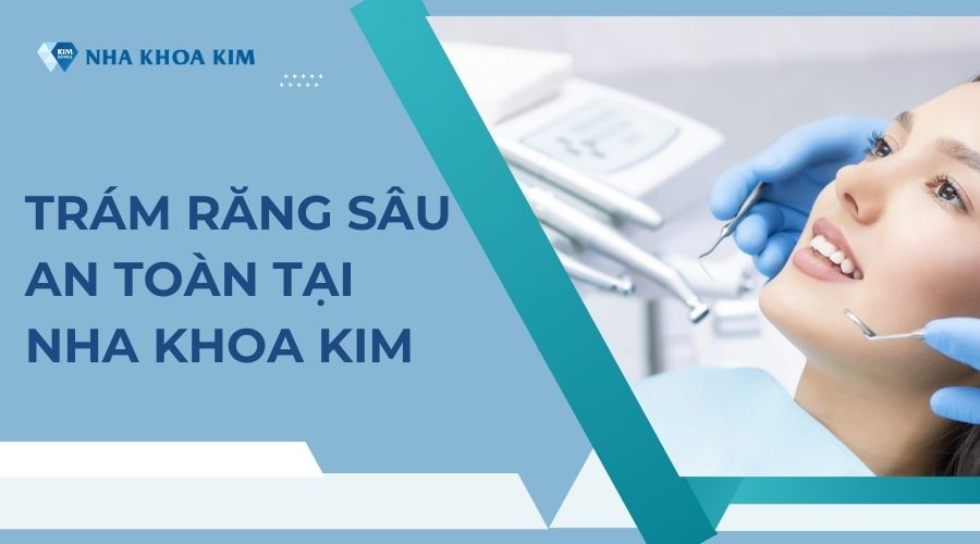 Dịch vụ trám răng sâu an toàn tại Nha Khoa Kim