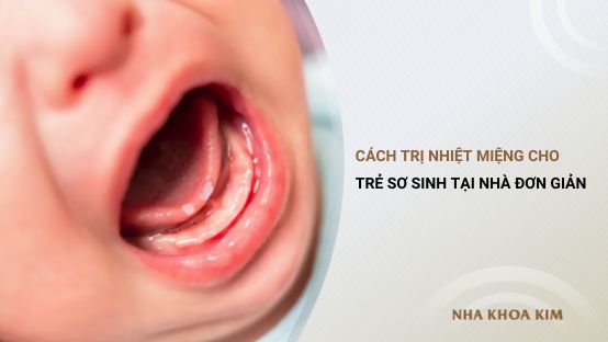 Cách trị nhiệt miệng cho trẻ sơ sinh tại nhà cực kỳ đơn giản