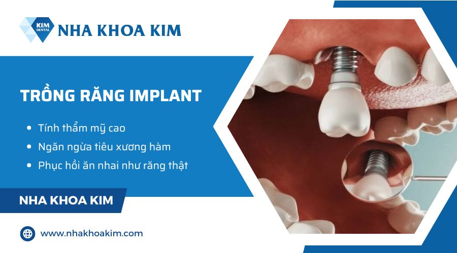 trồng răng implant