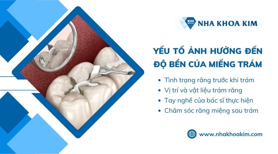 các yếu tố ảnh hưởng đến độ bền của miếng trám