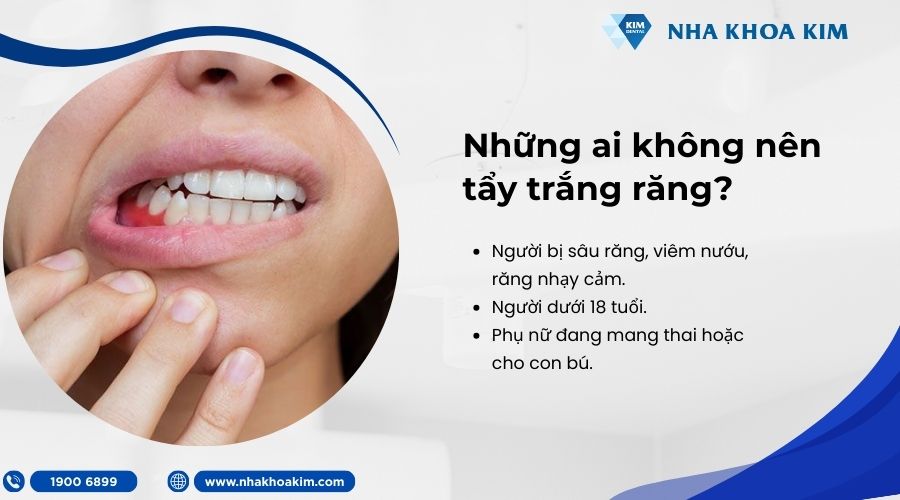 đối tượng không nên tẩy trắng răng