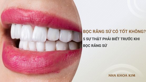 Bọc răng sứ có tốt không? Sự thật phải biết trước khi bọc răng sứ