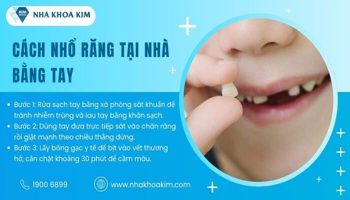nhổ răng tại nhà bằng tay
