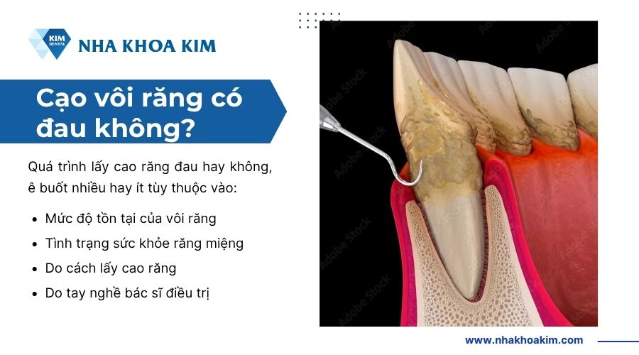 cạo vôi răng có đau không? có ê buốt không