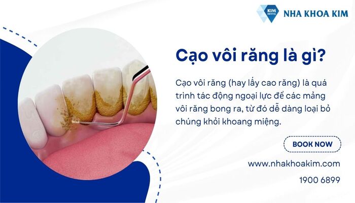 tác dụng của cạo vôi răng bao lâu thì ăn được