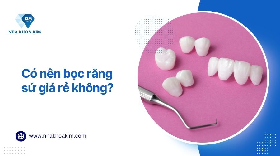có nên bọc răng sứ giá rẻ không