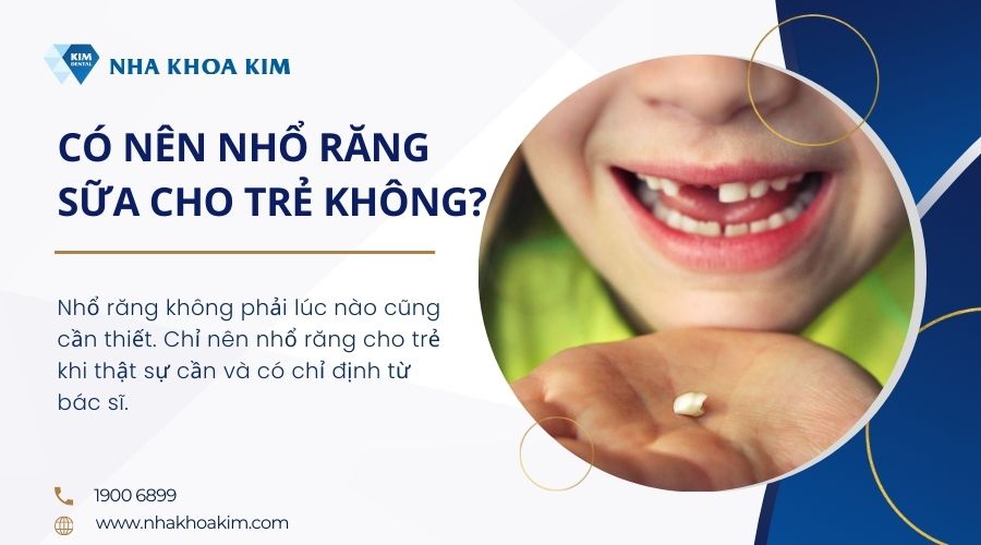 có nên nhổ răng cho trẻ em không