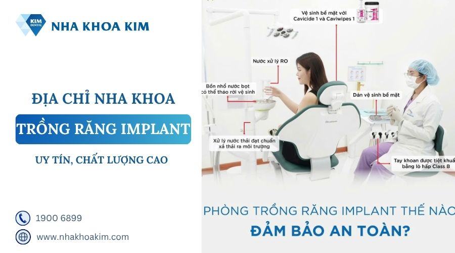 địa chỉ trồng răng uy tín, chất lượng cao