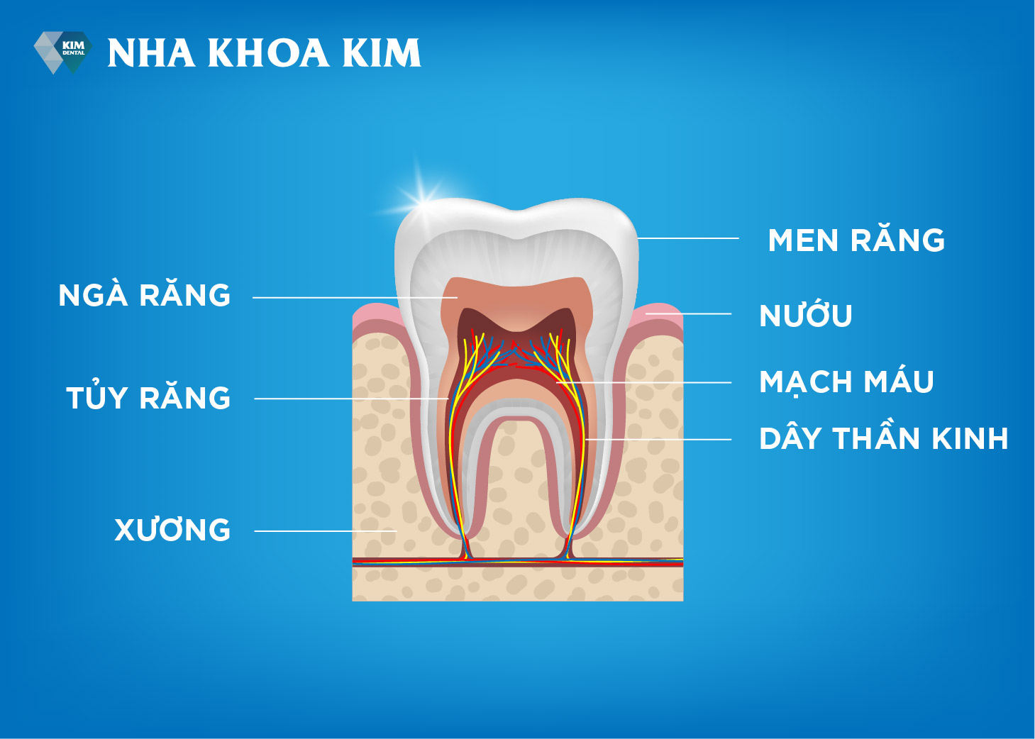 điều trị tủy răng an toàn tại Nha Khoa Kim