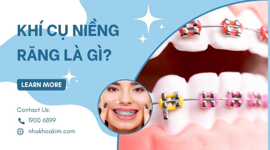 Khí cụ niềng răng là gì?