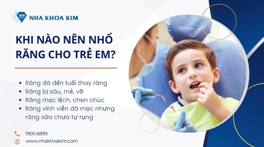 khi nào nên nhổ răng cho bé 