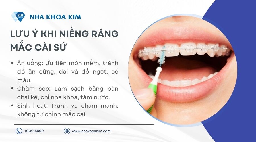 Những lưu ý khi niềng răng mắc cài sứ