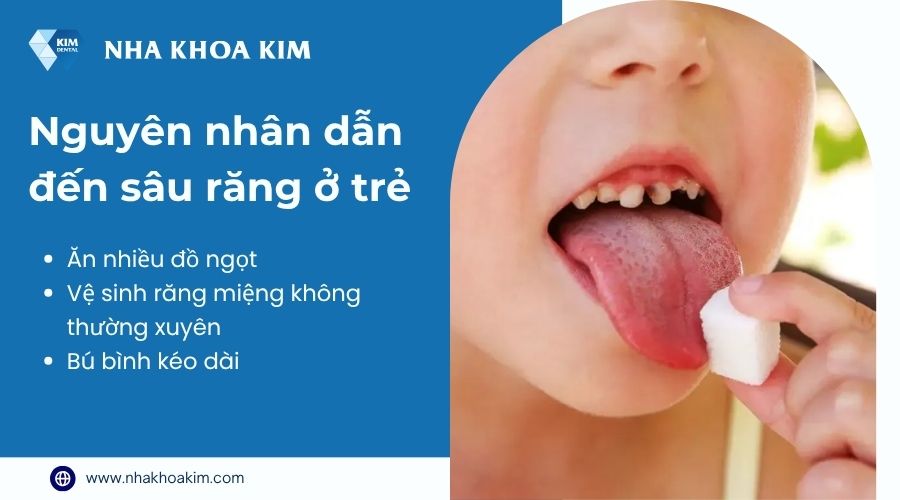 Nguyên nhân sâu răng trẻ em