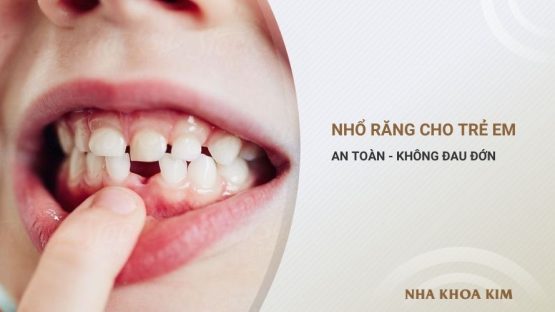 Nhổ răng trẻ em nhanh chóng, nhẹ nhàng và không gây đau đớn