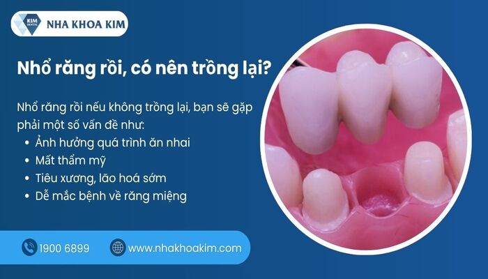 Nhổ răng không trồng lại có sao không