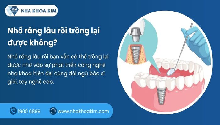 Nhổ răng lâu rồi trồng lại được không