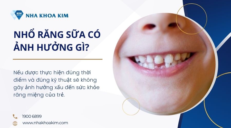 nhổ răng sữa có ảnh hưởng gì không