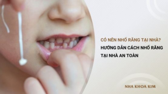 Có nên nhổ răng tại nhà? Hướng dẫn cách nhổ răng đúng