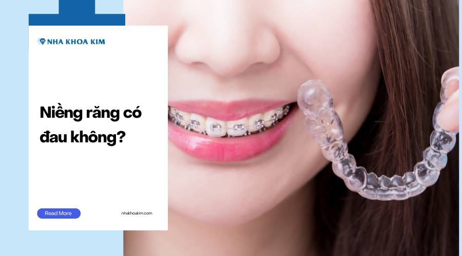 Niềng răng có đau không?