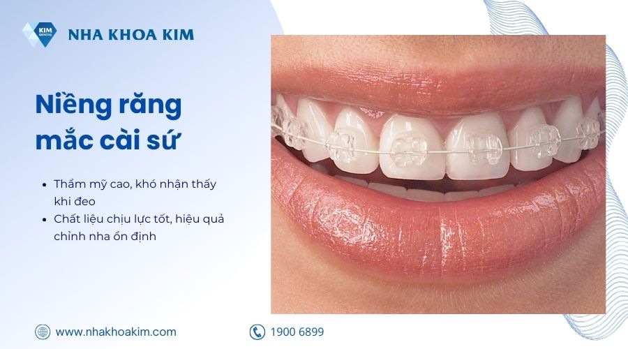 niềng mắc cài sứ