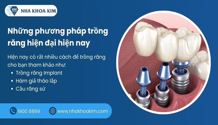  phương pháp trồng răng hiện đại