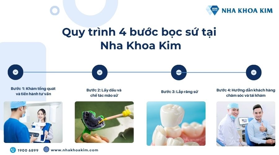 Quy trình 4 bước bọc sứ chuyên nghiệp tại Nha Khoa Kim