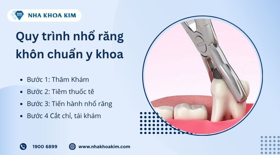 Quy trình nhổ răng khôn chuẩn y khoa