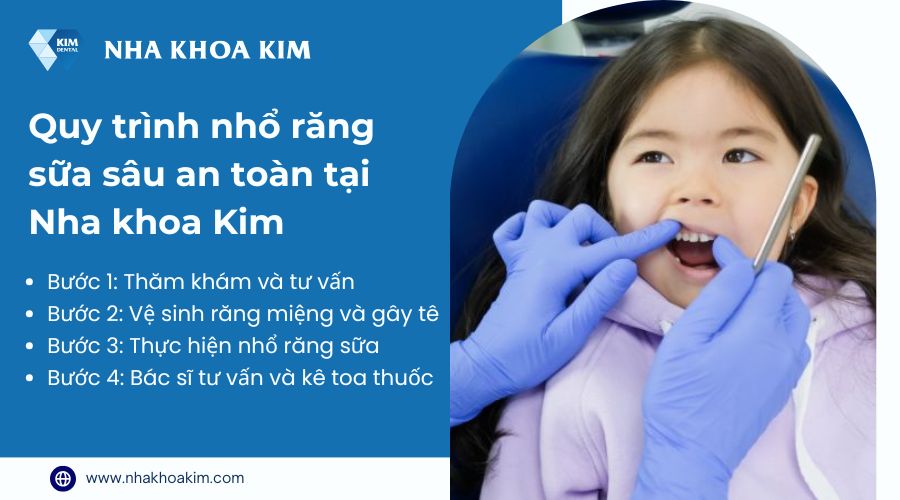 Quy trình nhổ răng sữa tại Nha Khoa Kim