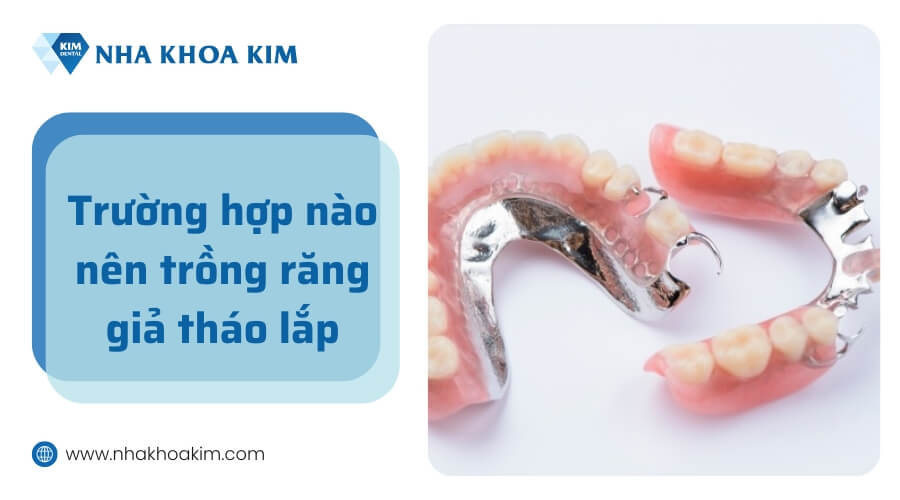 Trường hợp nào nên phục hình với răng giả tháo lắp