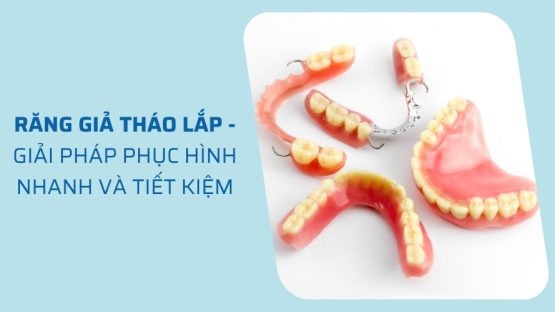 Chi Phí Trồng Răng Hàm Giả Tháo Lắp Bao Nhiêu Tiền?