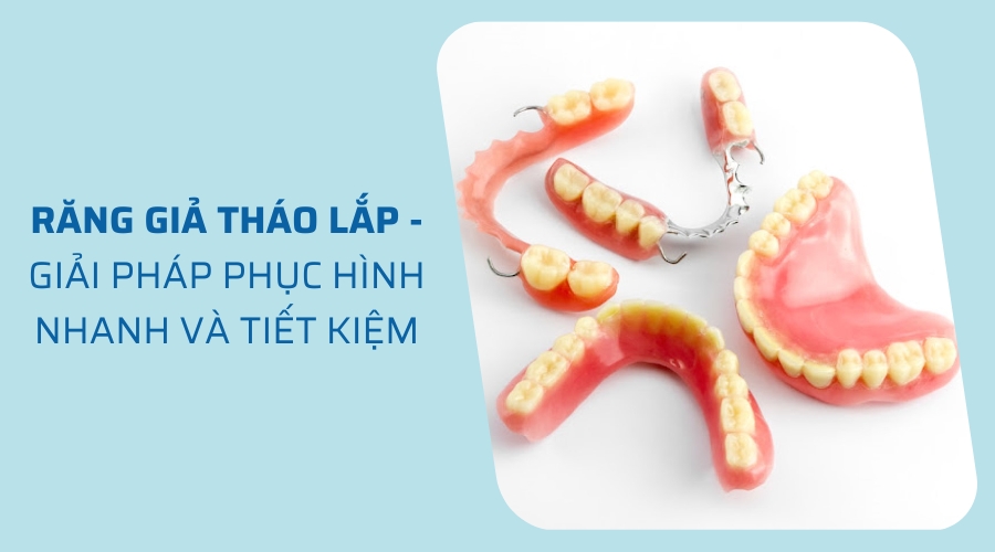 Răng giả tháo lắp - Giải pháp phục hình nhanh và tiết kiệm chi phí