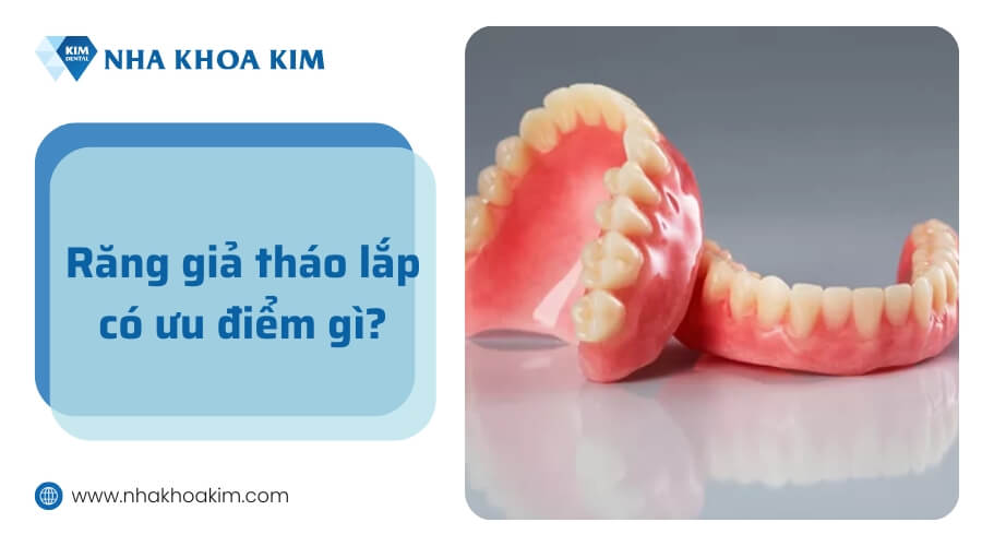 Có nên làm răng giả tháo lắp không?