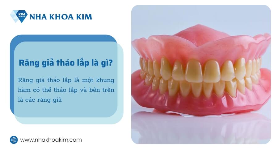 Răng giả tháo lắp là gì?