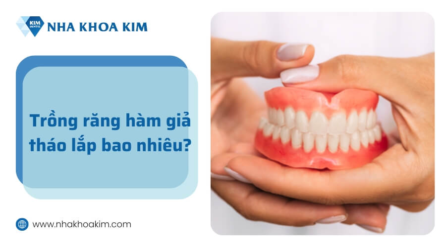 Trồng răng hàm giả tháo lắp giá bao nhiêu?
