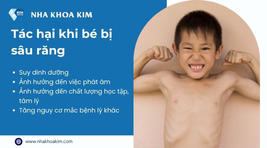 Bé bị sâu răng ảnh hưởng gì?