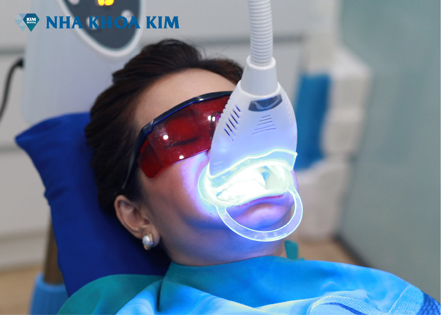 tẩy trắng răng hiệu quả tại Nha Khoa Kim
