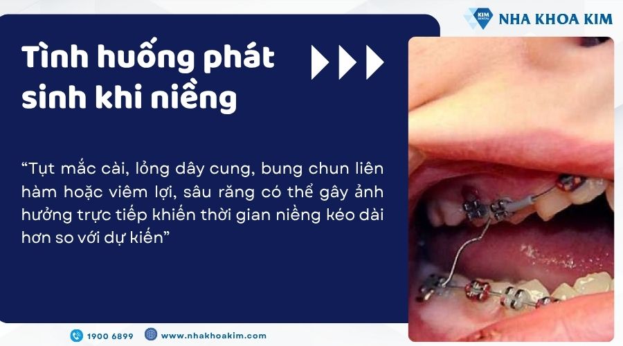 Tình huống phát sinh khi niềng