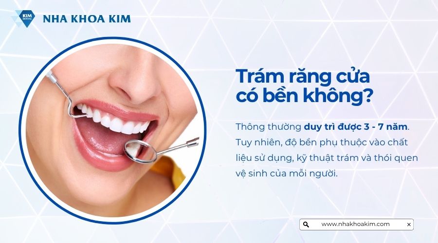 trám răng cửa có bền không