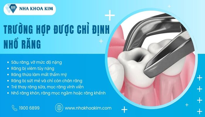 khi nào nên nhổ răng tại nhà
