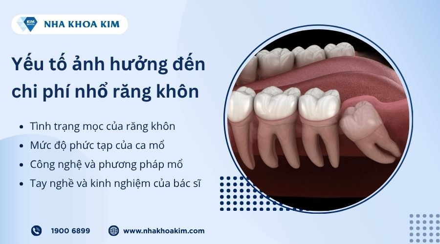 Yếu tố ảnh hưởng đến chi phí nhổ răng khôn