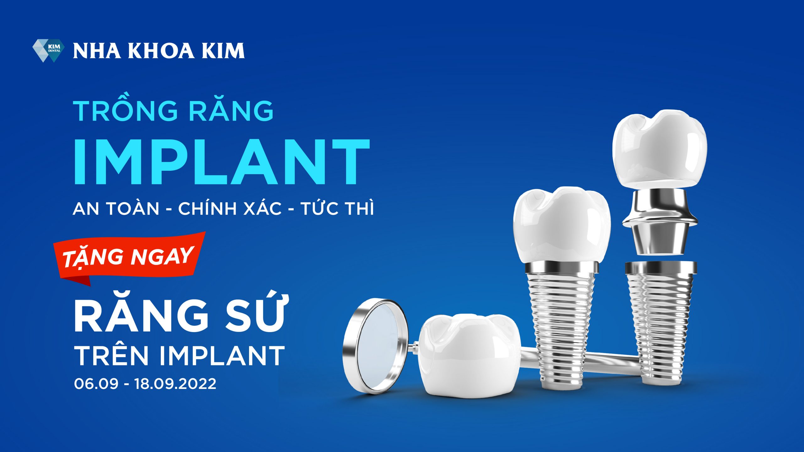 Trồng răng Implant An toàn Chính xác Tức thì Nha Khoa Kim