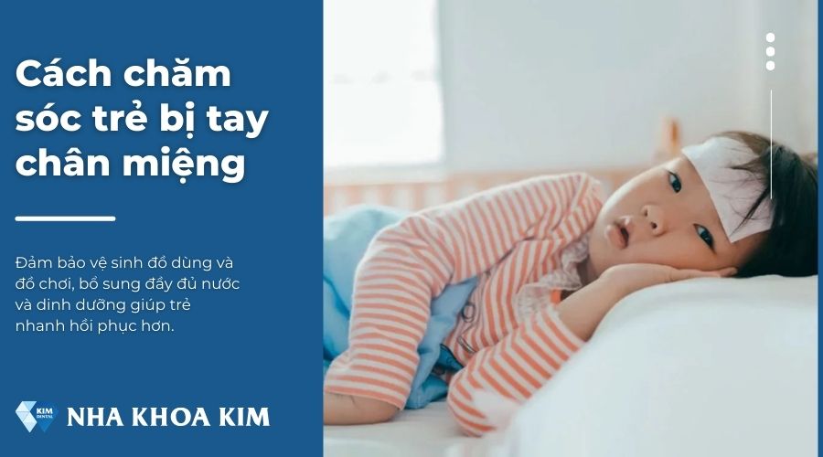 Cách chăm sóc trẻ bị tay chân miệng đúng cách