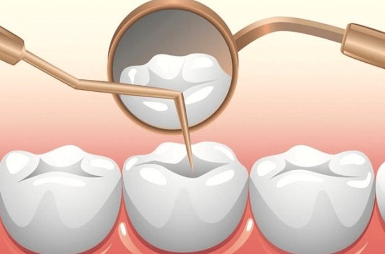 Khám phá một số bệnh lý về tủy răng
