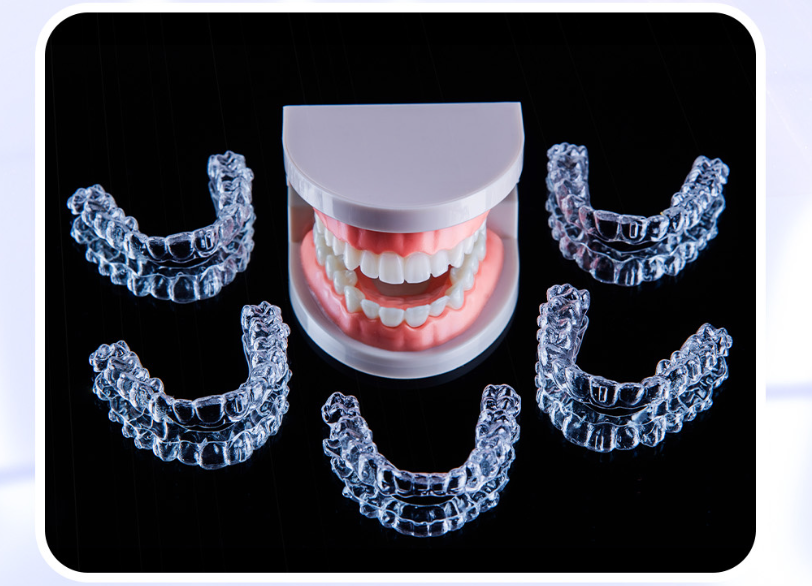 Ưu điểm của niềng răng trong suốt