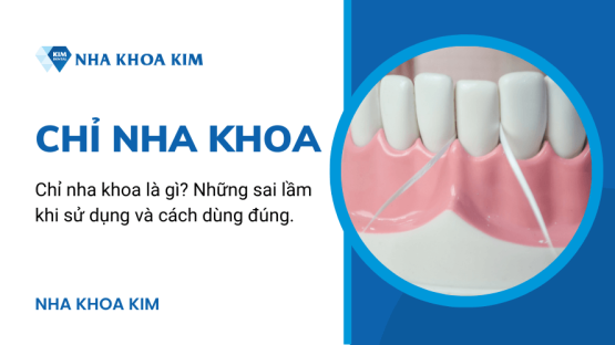 Chỉ nha khoa là gì? Cách dùng chỉ nha khoa đúng cách