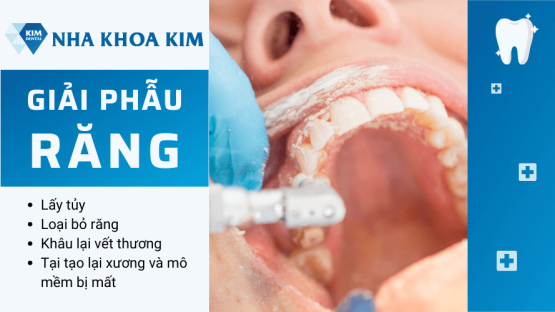 Giải phẫu răng là gì? Răng như thế nào thì cần giải phẫu?